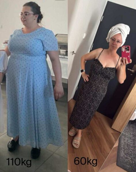 Zdjęcie metamorfozy #4