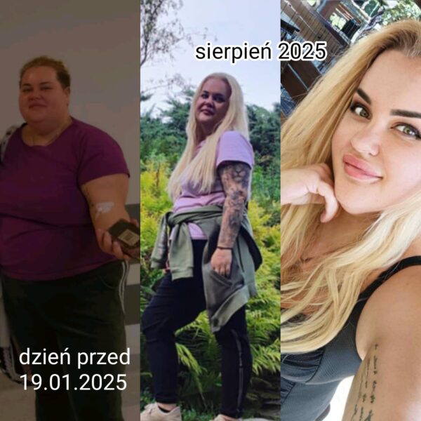 Zdjęcie metamorfozy #2