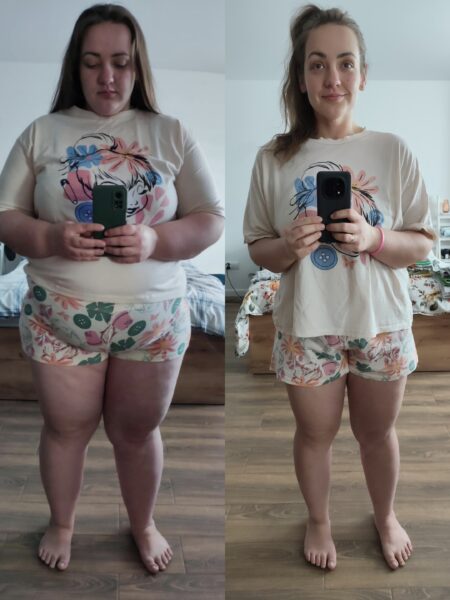 Zdjęcie metamorfozy #1